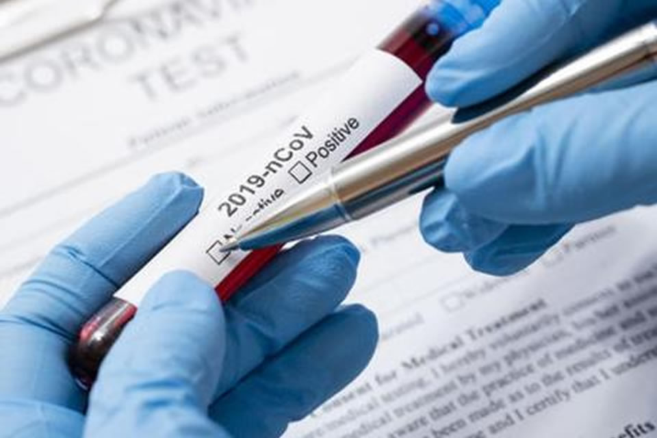 cORONAVIRUS TEST CALABRIA