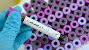 Kit vietati per la diagnosi del Covid, la Gdf ne sequestra un migliaio