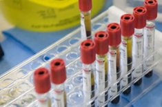 Sanit&agrave;. Da settembre meno analisi nelle strutture private accreditate