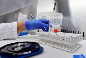 Coronavirus in Calabria: casi in leggero calo