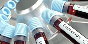 Covid-19: giornata tragica in Calabria, i positivi salgono a 494