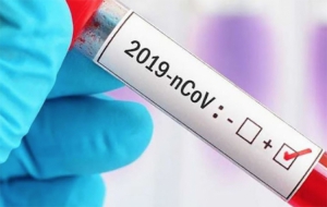 11 nuovi positivi di Coronavirus in Calabria
