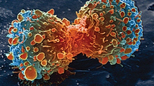 Calabria: la regione con meno malati di tumore