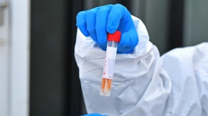 Tamponi in Calabria: Sapia non si arrende